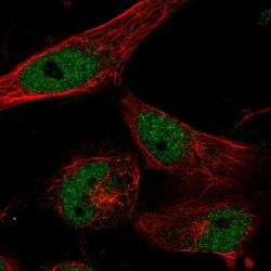 CLCN7 Antibody, Novus Biologicals:Antibodies:Primary Antibodies